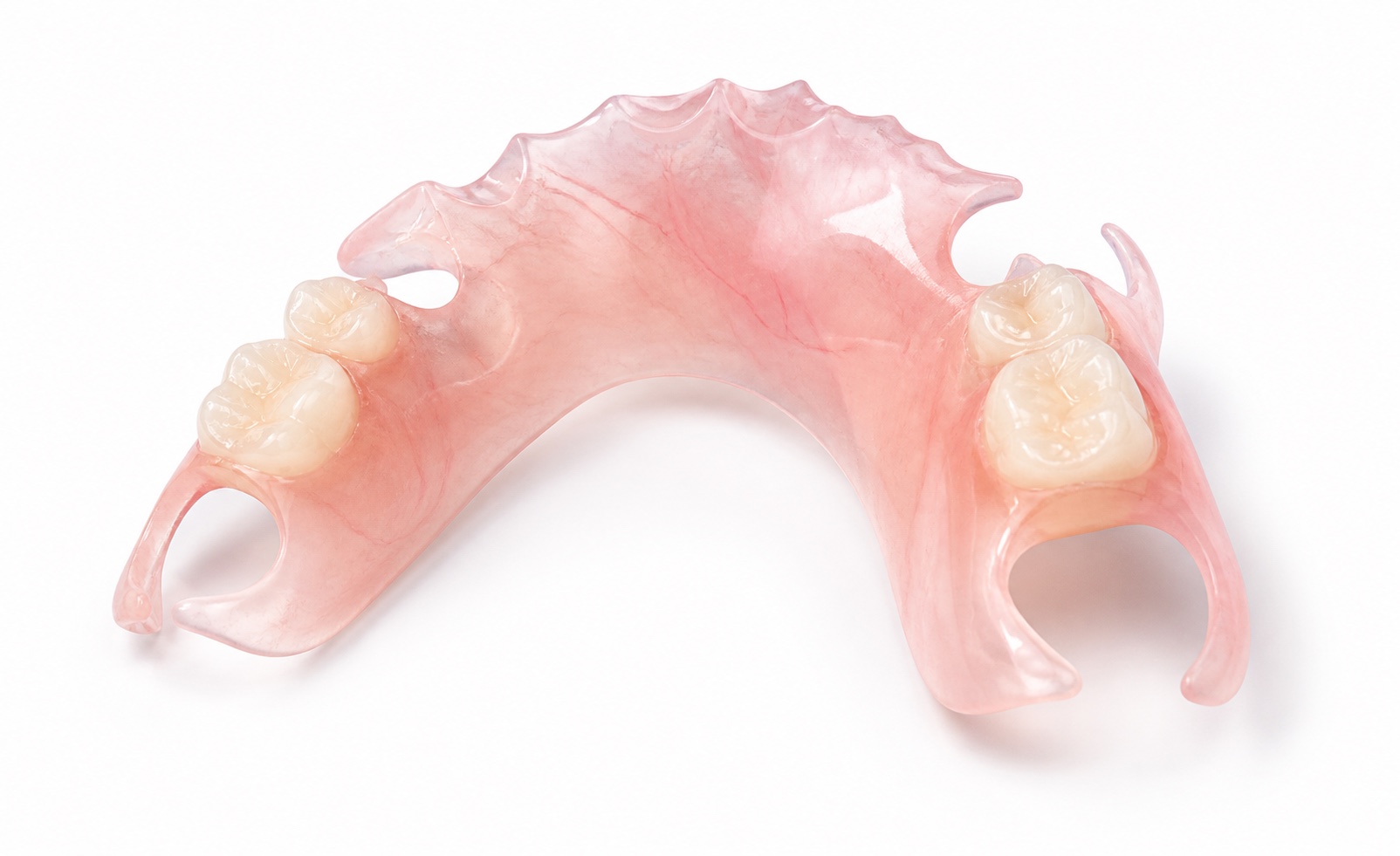 Flexible thermoplastic partial denture with translucent pink base