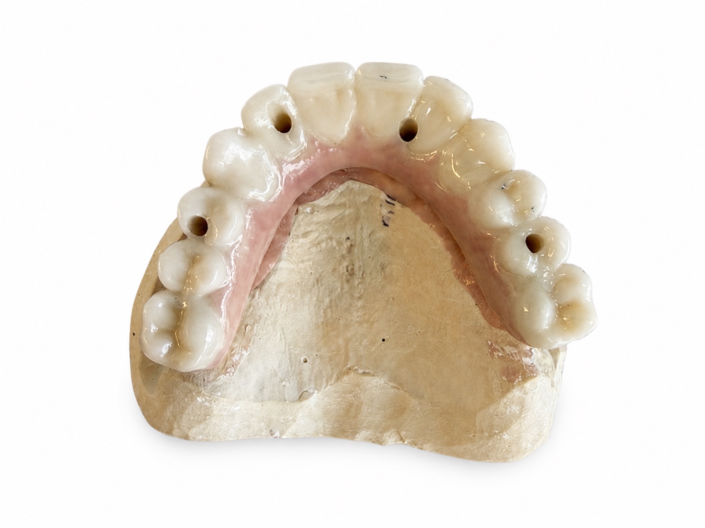 MyBite fixed full-arch implant bridge with four access points on a model