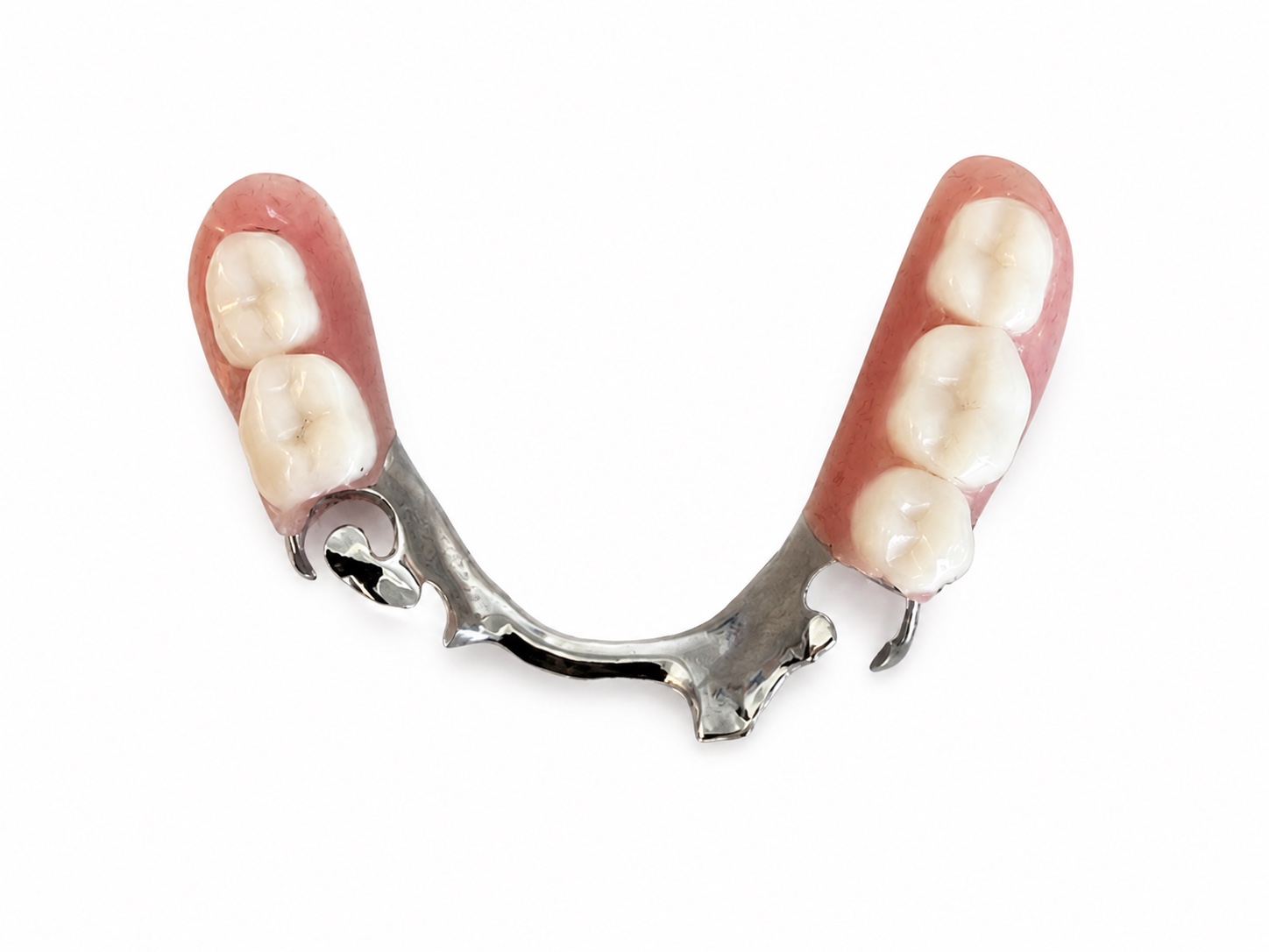 MyBite cast metal partial denture photographed in the lab