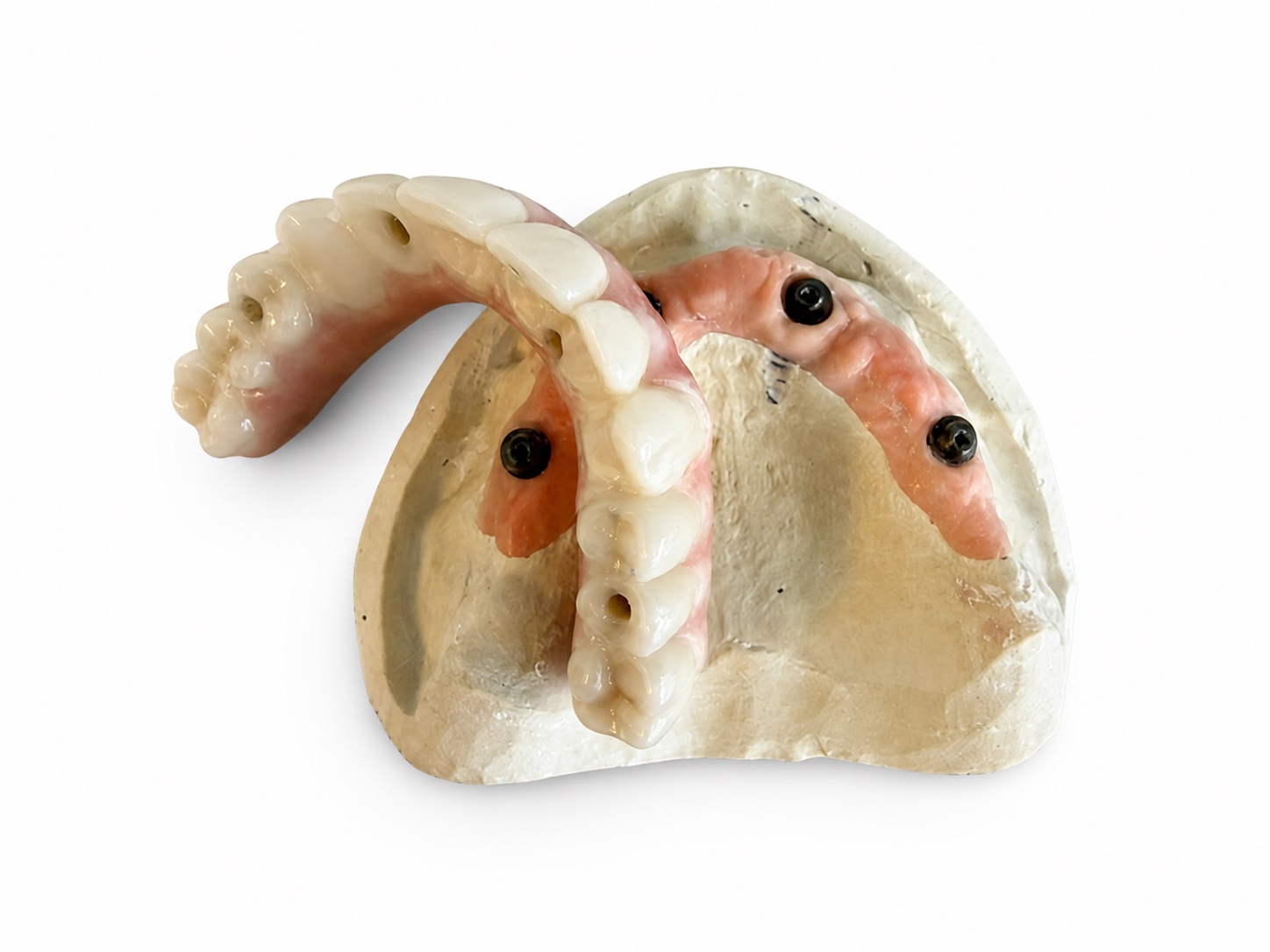MyBite fixed implant bridge positioned above its implant model