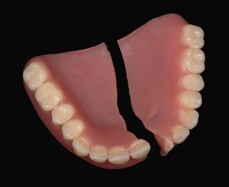 What to Do If Your Dentures Break: A Step-by-Step Emergency Guide
